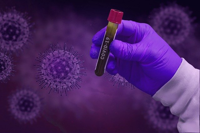  РЗИ Пазарджик: 84 положителни проби за коронавирус (6-12-2020)