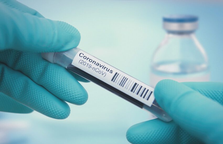  РЗИ-Пазарджик: 69 положителни проби за коронавирус на 35 жени и 34 мъже (2-12-2020)