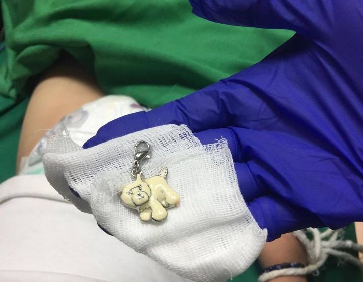  Дете на 2 години от Велинград е спасено от лекари от МБАЛ-Пазарджик, след като погълнало играчка-ключодържател от пакет с кроки.